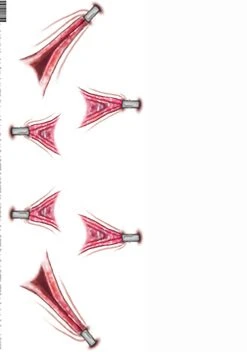 Tinsley Transfers Trauma Stretched Temporary Costume Tattoo 5 Tinsley Transfers Trauma Stretched Temporary Costume Tattoo -Cheap Halloween Store trauma stretched temporary tattoo alt 2