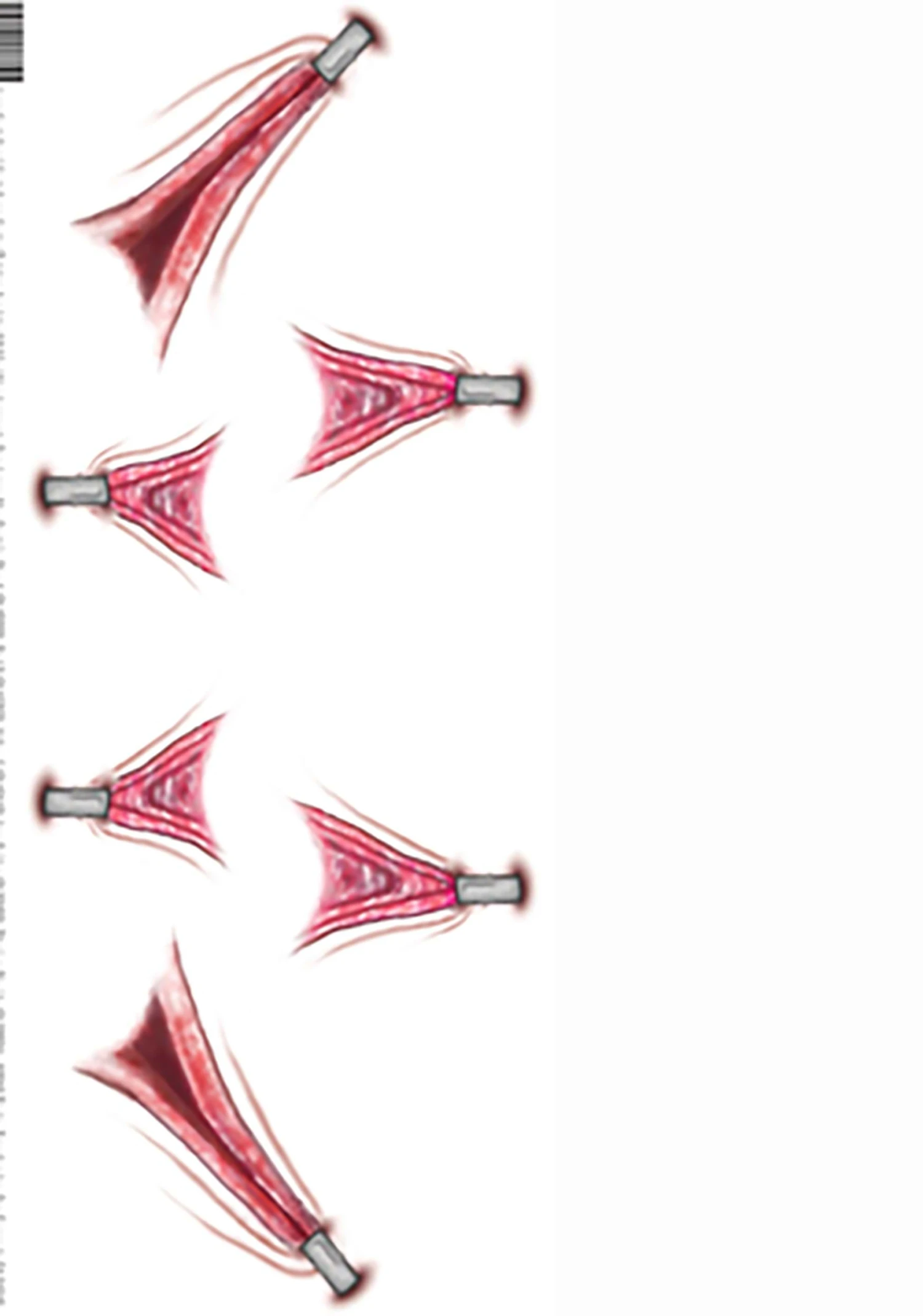 Tinsley Transfers Trauma Stretched Temporary Costume Tattoo 3 Tinsley Transfers Trauma Stretched Temporary Costume Tattoo - Image 3